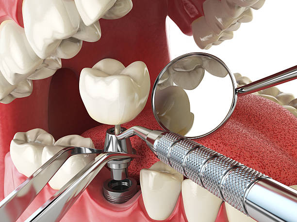 Best Emergency Dental Extractions in Chocowinity, NC